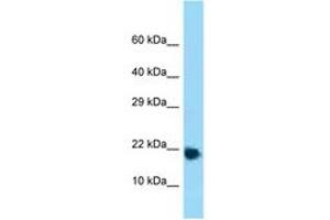 Image no. 1 for anti-Ribosomal Protein L32 (RPL32) (AA 61-110) antibody (ABIN6748313) (RPL32 antibody  (AA 61-110))