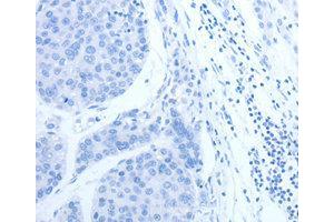 Immunohistochemistry (IHC) image for anti-Complement Factor H-Related 1 (CFHR1) antibody (ABIN1871806) (CFHR1 antibody)