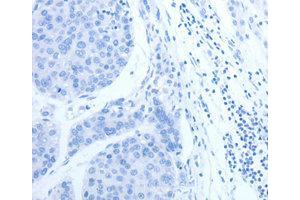 Immunohistochemistry (IHC) image for anti-Complement Factor H-Related 1 (CFHR1) antibody (ABIN1871806)