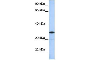 KCTD4 antibody used at 1 ug/ml to detect target protein. (KCTD4 antibody  (Middle Region))