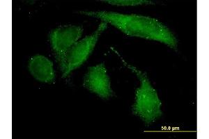 Immunofluorescence of monoclonal antibody to ROCK2 on HeLa cell. (ROCK2 antibody  (AA 1279-1388))