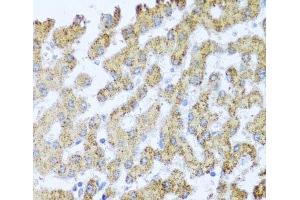 Immunohistochemistry of paraffin-embedded Human liver using MOK Polyclonal Antibody at dilution of 1:100 (40x lens). (MOK antibody)