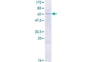 SDS-PAGE (SDS) image for Mesoderm Specific Transcript (MEST) (AA 1-335) protein (GST tag) (ABIN1781088) (MEST Protein (AA 1-335) (GST tag))