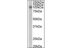 Image no. 1 for anti-ADAM Metallopeptidase Domain 8 (ADAM8) (C-Term) antibody (ABIN374195) (ADAM8 antibody  (C-Term))