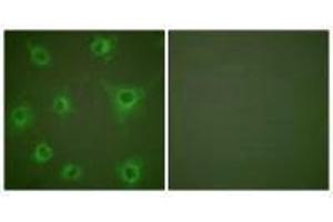 Immunofluorescence analysis of COS7 cells, using Collagen II antibody. (COL2A1 antibody)