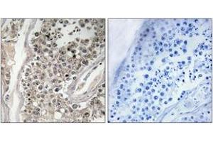 Immunohistochemistry analysis of paraffin-embedded human testis tissue, using RAB3GAP1 Antibody.