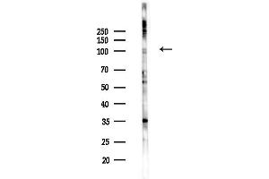 anti-Discs, Large (Drosophila) Homolog-Associated Protein 1 (DLGAP1) (Internal Region) antibody