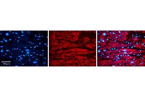 Rabbit Anti-VDAC2 Antibody   Formalin Fixed Paraffin Embedded Tissue: Human heart Tissue Observed Staining: Cytoplasmic Primary Antibody Concentration: N/A Other Working Concentrations: 1:600 Secondary Antibody: Donkey anti-Rabbit-Cy3 Secondary Antibody Concentration: 1:200 Magnification: 20X Exposure Time: 0. (VDAC2 antibody  (N-Term))