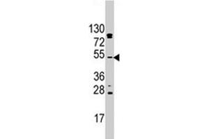 Western blot analysis of AKT2 polyclonal antibody  in mouse liver tissue lysates (35 ug/lane).