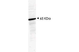 Western blot using HDAC1 polyclonal antibody  shows detection of a band at ~65 KDa corresponding to human HDAC1 present in a 293 whole cell lysate (arrowhead). (HDAC1 antibody  (AA 466-482))