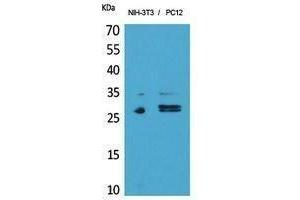 Western Blotting (WB) image for anti-Tumor Necrosis Factor Receptor Superfamily, Member 10c (TNFRSF10C) (Internal Region) antibody (ABIN6280790) (DcR1 antibody  (Internal Region))