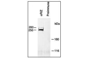 Image no. 1 for anti-PR Domain Containing 2, with ZNF Domain (PRDM2) (AA 245-573) antibody (ABIN356710) (PRDM2 antibody  (AA 245-573))