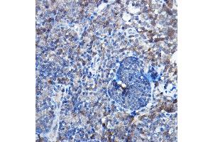 Immunohistochemistry of paraffin-embedded rat lymph node using Bax Rabbit mAb  at dilution of 1:25,1:50 (40x lens). (BAX antibody)