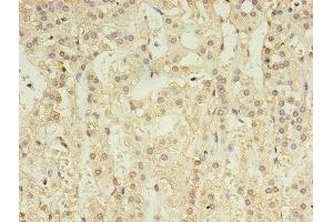 Immunohistochemistry (IHC) image for anti-gamma-aminobutyric Acid (GABA) A Receptor, alpha 4 (GABRA4) (AA 36-258) antibody (ABIN7153483)