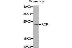 Western blot analysis of extracts of mouse liver, using ACP1 Antibody.
