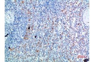Immunohistochemical analysis of paraffin-embedded human-spleen, antibody was diluted at 1:200 (CD236/GYPC antibody  (AA 11-60))