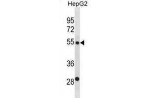 Western Blotting (WB) image for anti-ST6 beta-Galactosamide alpha-2,6-Sialyltranferase 2 (ST6GAL2) antibody (ABIN3000959) (ST6GAL2 antibody)