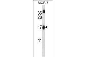 Western blot analysis in MCF-7 cell line lysates (35ug/lane). (UBE2W antibody  (C-Term))