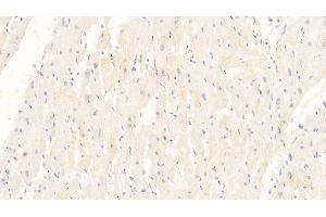 Detection of DKK2 in Human Cardiac Muscle Tissue using Monoclonal Antibody to Dickkopf Related Protein 2 (DKK2) (DKK2 antibody  (AA 38-258))