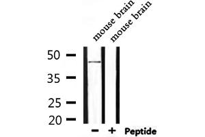 Western blot analysis of extracts from mouse brain, using NMUR1 Antibody. (NMUR1 antibody  (N-Term))