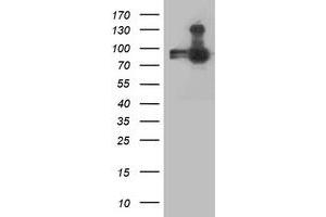 Western Blotting (WB) image for anti-Anaphase Promoting Complex Subunit 2 (ANAPC2) antibody (ABIN1496638) (ANAPC2 antibody)