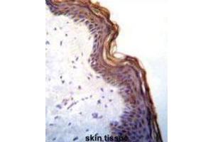 Immunohistochemistry (IHC) image for anti-Kallikrein 7 (KLK7) antibody (ABIN3002618) (Kallikrein 7 antibody)