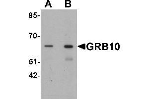 Western blot analysis of GRB10 in SK-N-SH cell lysate with GRB10 antibody at (A) 1 and (B) 2 µg/mL. (GRB10 antibody  (C-Term))