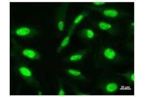 Immunostaining analysis in HeLa cells. (CHD6 antibody)