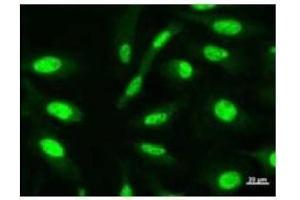 Immunostaining analysis in HeLa cells. (CHD6 antibody)