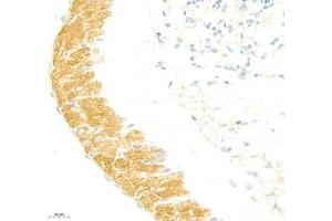 Immunohistochemistry of paraffin embedded mouse lung using collagen alpha-1 (V) (ABIN7073547) at dilution of 1: 1800 (400x lens) (Collagen Type V antibody)