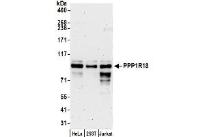 Western Blotting (WB) image for anti-KIAA1949 (KIAA1949) (AA 325-375) antibody (ABIN7452798)