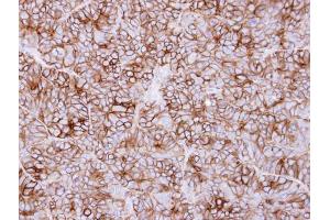 IHC-P Image Immunohistochemical analysis of paraffin-embedded SW480 xenograft, using KIDINS220, antibody at 1:500 dilution. (KIDINS220 antibody  (C-Term))