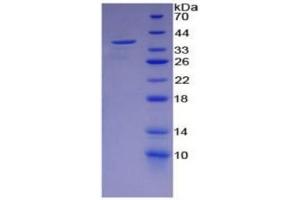 SDS-PAGE of Protein Standard from the Kit  (Highly purified E. (ENO2/NSE ELISA Kit)