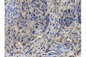 Immunohistochemistry (IHC) image for anti-Calcium/calmodulin-Dependent serine Protein Kinase (MAGUK Family) (CASK) antibody (ABIN1871447) (CASK antibody)