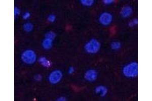 Immunofluorescence analysis of Rat liver tissue using Phospho-Pan-Akt (Ser473) Polyclonal Antibody at dilution of 1:200 (AKT1 antibody  (pSer473))