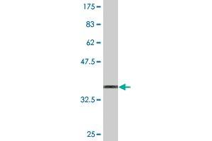 Western Blot detection against Immunogen (36. (Oncostatin M Receptor antibody  (AA 141-240))