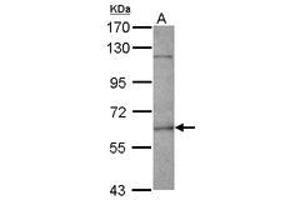 Image no. 2 for anti-Fanconi Anemia, Complementation Group E (FANCE) (AA 205-482) antibody (ABIN1498219) (FANCE antibody  (AA 205-482))
