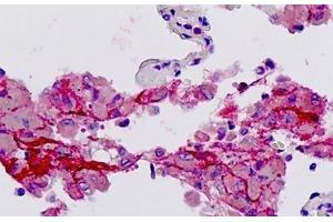 Human Lung: Formalin-Fixed, Paraffin-Embedded (FFPE) (PAR1 antibody  (Cleaved-Ser42))