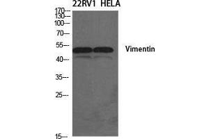 Western Blot (WB) analysis of specific cells using Vimentin Polyclonal Antibody. (Vimentin antibody  (Tyr317))