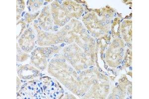 Immunohistochemistry of paraffin-embedded Mouse kidney using MYLK Polyclonal Antibody at dilution of 1:100 (40x lens). (MYLK antibody)