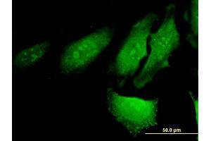 Immunofluorescence of monoclonal antibody to RERG on HeLa cell. (RERG antibody  (AA 1-199))
