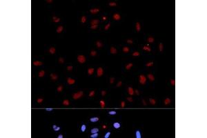Immunofluorescence analysis of U2OS cells using Phospho-MET(Y1235) Polyclonal Antibody (c-MET antibody  (pTyr1235))