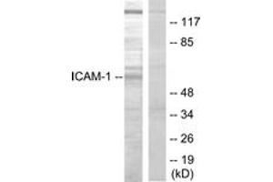 Western blot analysis of extracts from HepG2 cells, using ICAM-1 (Ab-512) Antibody. (ICAM1 antibody  (AA 479-528))