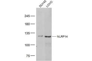 Lane 1: DU145 lysates Lane 2: LOVO lysates probed with NLRP14 Polyclonal Antibody, Unconjugated  at 1:300 dilution and 4˚C overnight incubation.