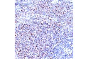 Immunohistochemistry of paraffin-embedded rat spleen using TC10/RHOQ Rabbit mAb (ABIN7269869) at dilution of 1:100 (40x lens). (RHOQ antibody)