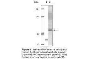 Image no. 1 for anti-V-Akt Murine Thymoma Viral Oncogene Homolog 3 (Protein Kinase B, Gamma) (AKT3) antibody (ABIN232105) (AKT3 antibody)