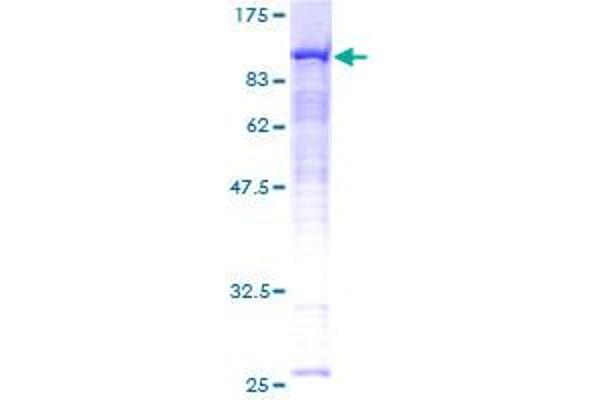 Radixin Protein (RDX) (AA 1-583) (GST tag)