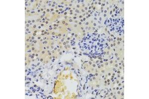 Immunohistochemistry (IHC) image for anti-Heterogeneous Nuclear Ribonucleoprotein A1 (HNRNPA1) (AA 1-372) antibody (ABIN6141896)