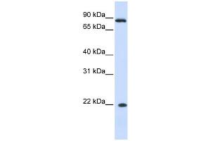 WB Suggested Anti-IFNA7 Antibody Titration: 0. (IFNA7 antibody  (N-Term))
