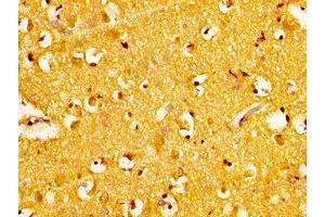 IHC image of ABIN7168283 diluted at 1:300 and staining in paraffin-embedded human brain tissue performed on a Leica BondTM system. (NAT1 antibody  (AA 909-1025))